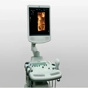 Máy Siêu Âm Màu 4D